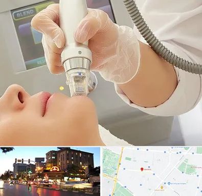 آر اف فرکشنال در بلوار سجاد مشهد 