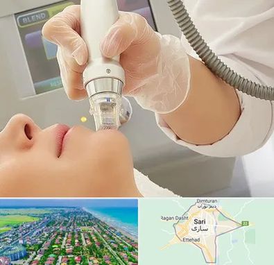 آر اف فرکشنال در ساری