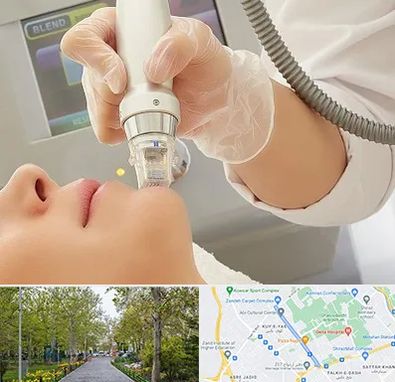 آر اف فرکشنال در قدوسی غربی شیراز