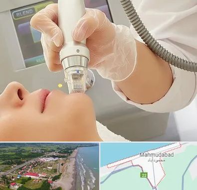 آر اف فرکشنال در محمودآباد