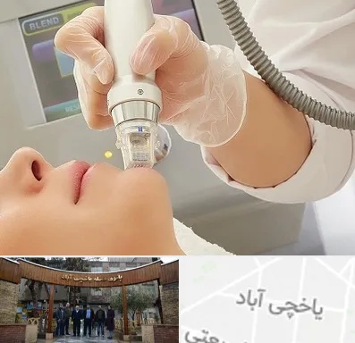 آر اف فرکشنال در یاخچی آباد