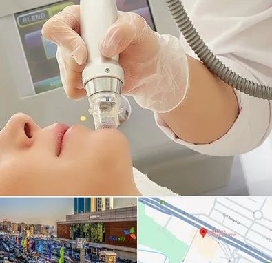 آر اف فرکشنال در لاله پارک تبریز