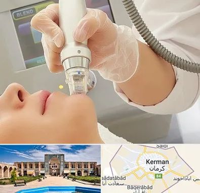 آر اف فرکشنال در کرمان