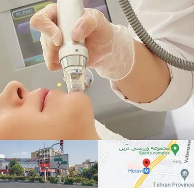 آر اف فرکشنال در هروی 