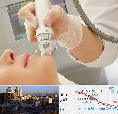 آر اف فرکشنال در فرمانیه 