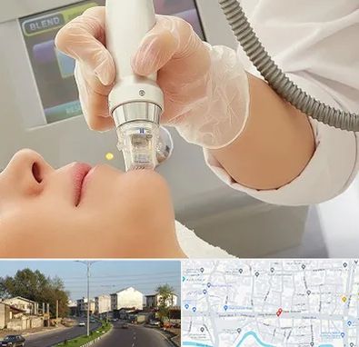 آر اف فرکشنال در ضیابری رشت