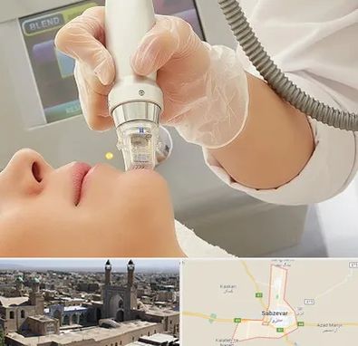 آر اف فرکشنال در سبزوار