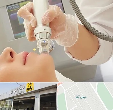 آر اف فرکشنال در عبدل آباد