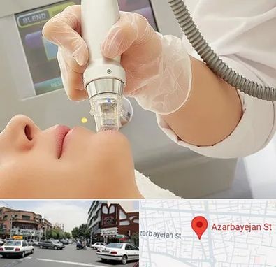 آر اف فرکشنال در خیابان آذربایجان