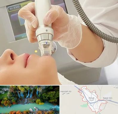 آر اف فرکشنال در دورود