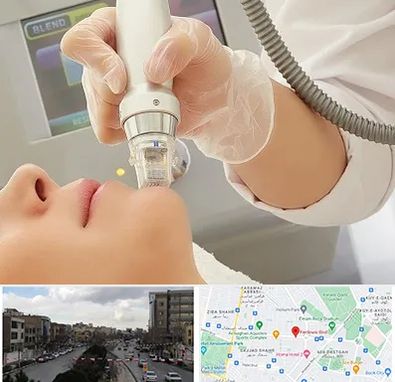 آر اف فرکشنال در بلوار فردوسی مشهد