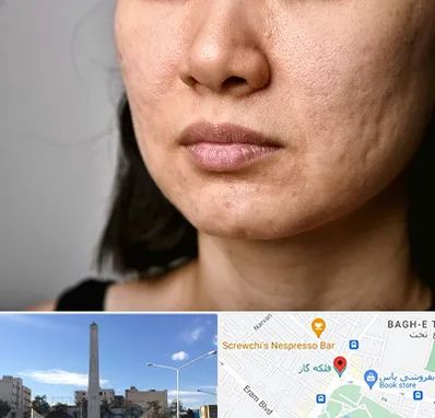 سابسیژن جای جوش در فلکه گاز شیراز