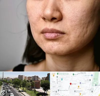 سابسیژن جای جوش در شهرک آزمایش 