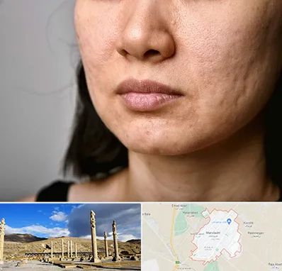 سابسیژن جای جوش در مرودشت