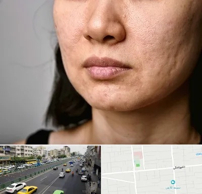 سابسیژن جای جوش در خیابان دامپزشکی
