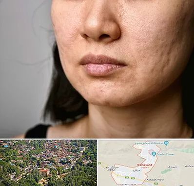 سابسیژن جای جوش در دماوند