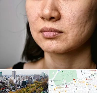 سابسیژن جای جوش در بلوار کشاورز 