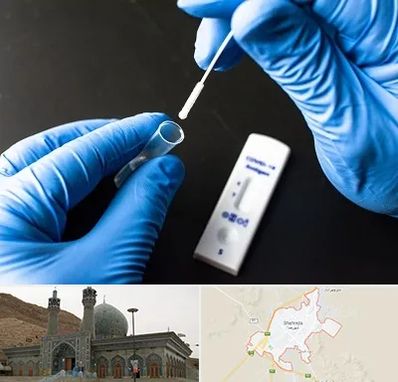 آزمایشگاه پی سی آر در شهرضا