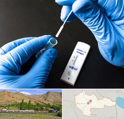 آزمایشگاه پی سی آر در خاش