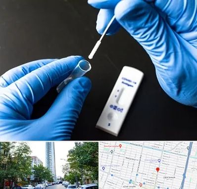 آزمایشگاه پی سی آر در امامت مشهد