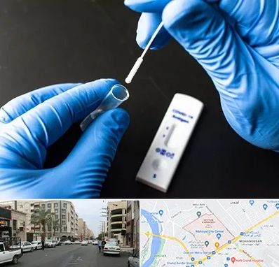 آزمایشگاه پی سی آر در زیتون کارمندی اهواز