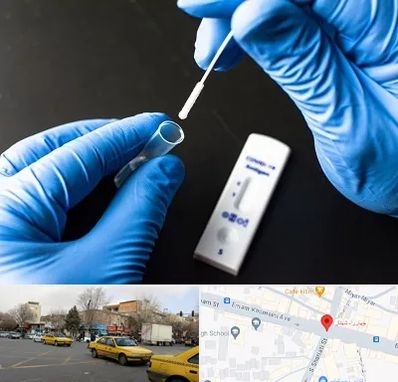 آزمایشگاه پی سی آر در شهناز تبریز