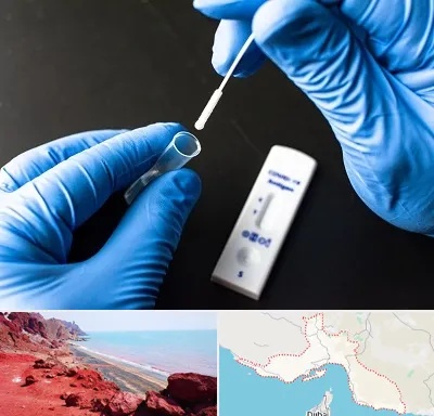 آزمایشگاه پی سی آر در هرمزگان