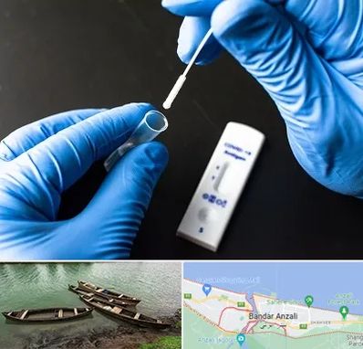 آزمایشگاه پی سی آر در بندر انزلی