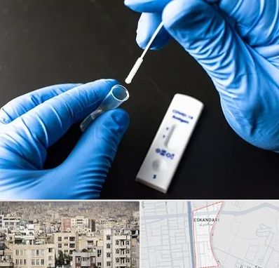 آزمایشگاه پی سی آر در اسکندری