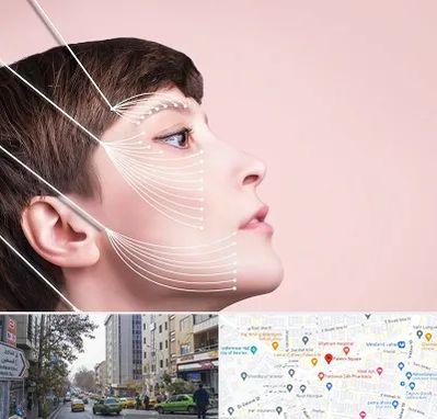 اندولیفت پیشانی در فاطمی 