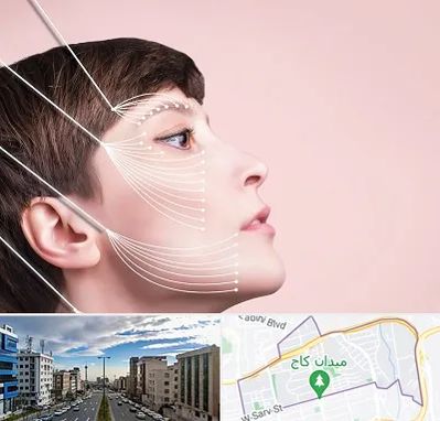 اندولیفت پیشانی در سعادت آباد 