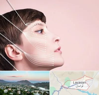 اندولیفت پیشانی در لواسان