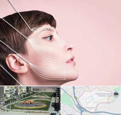 اندولیفت پیشانی در مرزداران تبریز