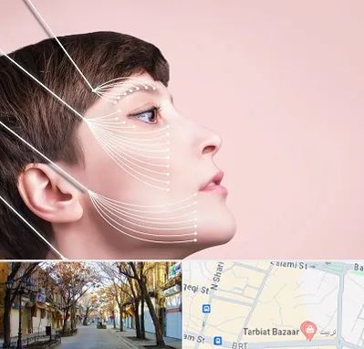 اندولیفت پیشانی در تربیت تبریز