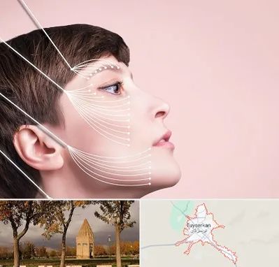 اندولیفت پیشانی در تویسرکان
