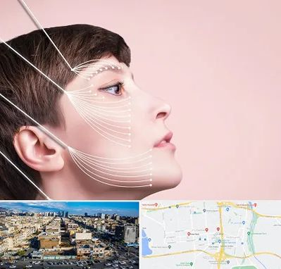 اندولیفت پیشانی در شهرک راه آهن