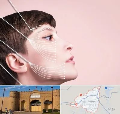 اندولیفت پیشانی در ایرانشهر