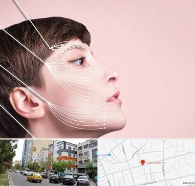 اندولیفت پیشانی در هفده شهریور تبریز