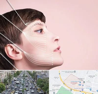 اندولیفت پیشانی در گلشهر کرج