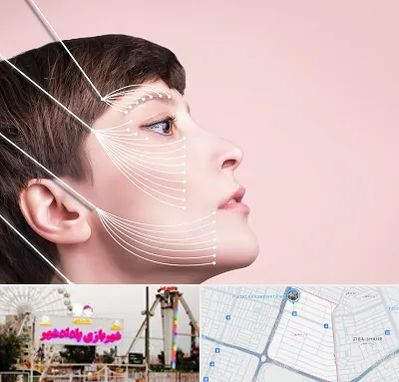 اندولیفت پیشانی در پادادشهر اهواز