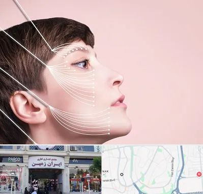 اندولیفت پیشانی در ایران زمین