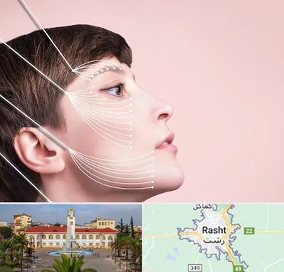 اندولیفت پیشانی در رشت