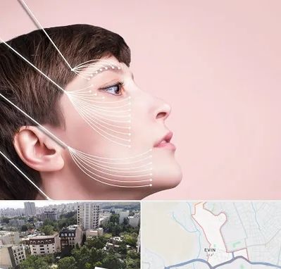 اندولیفت پیشانی در اوین