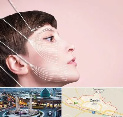 اندولیفت پیشانی در زنجان