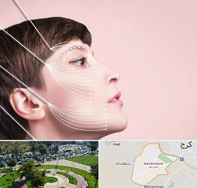 اندولیفت پیشانی در مهرشهر کرج 