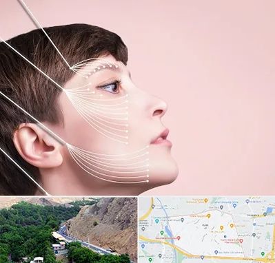 اندولیفت پیشانی در کن 