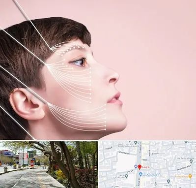 اندولیفت پیشانی در خیابان توحید اصفهان