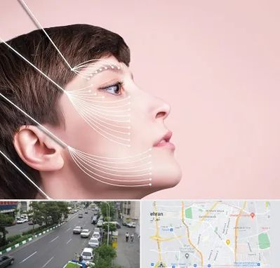 اندولیفت پیشانی در ستارخان 