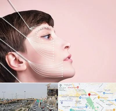 اندولیفت پیشانی در بلوار توس مشهد 