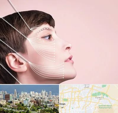 اندولیفت پیشانی در شرق تهران 